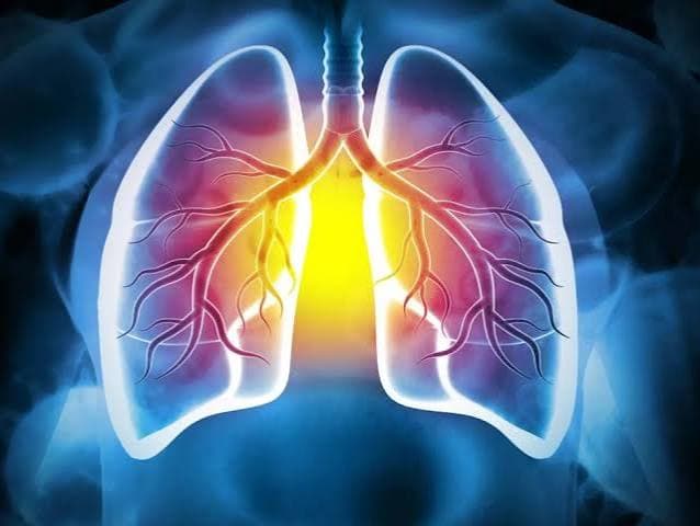 Bronquitis