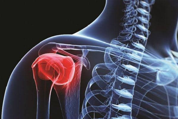 Cáncer óseo