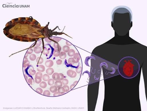 Chagas