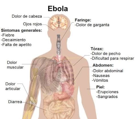 Ébola