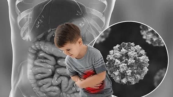 Gastroenteritis