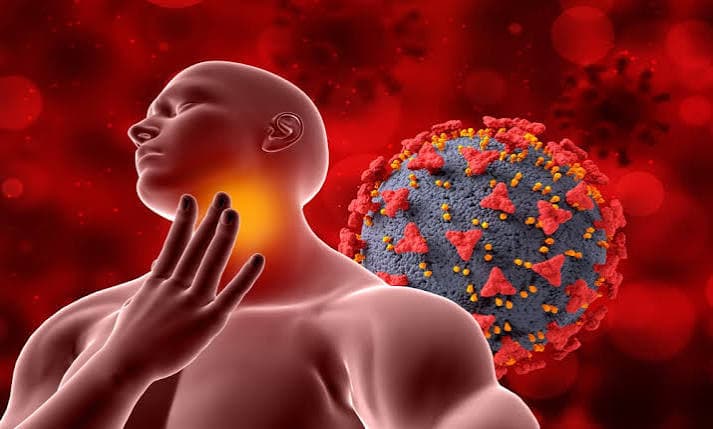 Mononucleosis (consultar apartado “Virus Epstein-Barr”
