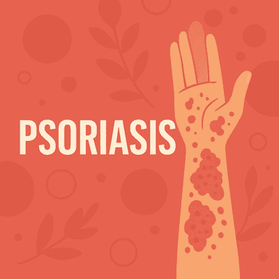 Psoriasis