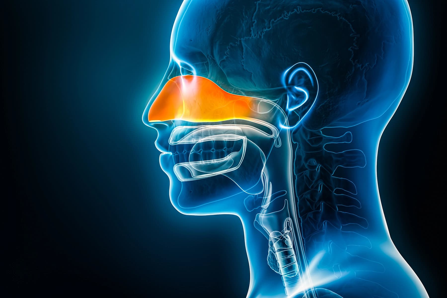 Sinusitis